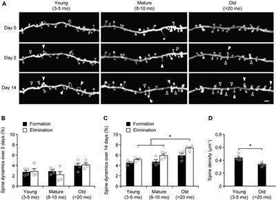 Learning-Dependent Dendritic Spine Plasticity Is Reduced in the Aged Mouse Cortex